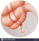 apendix