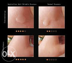 Argirelin anti age prirodni botox protiv bora